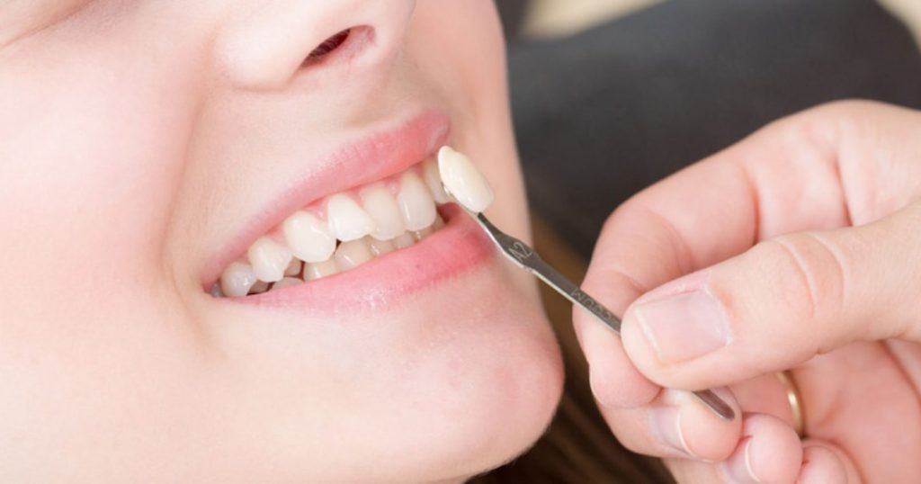 3 Issues Cosmetic Dentists Can Address